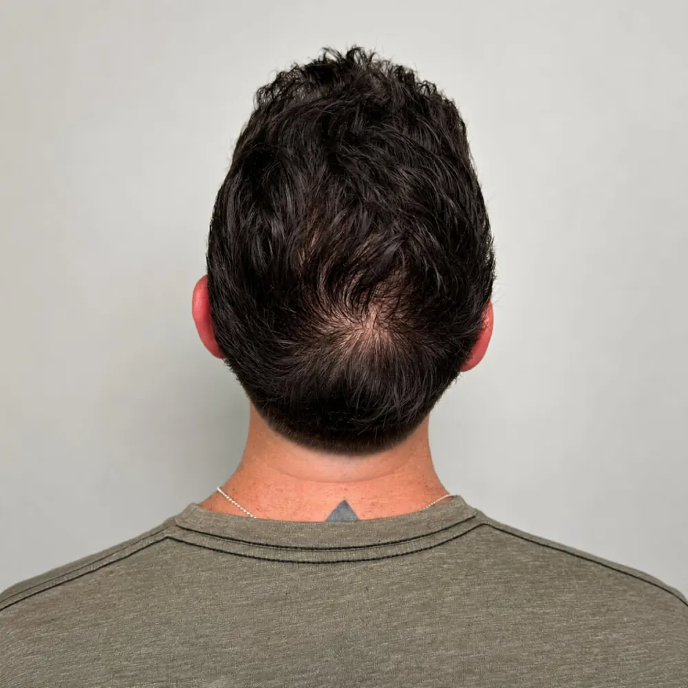 10th month