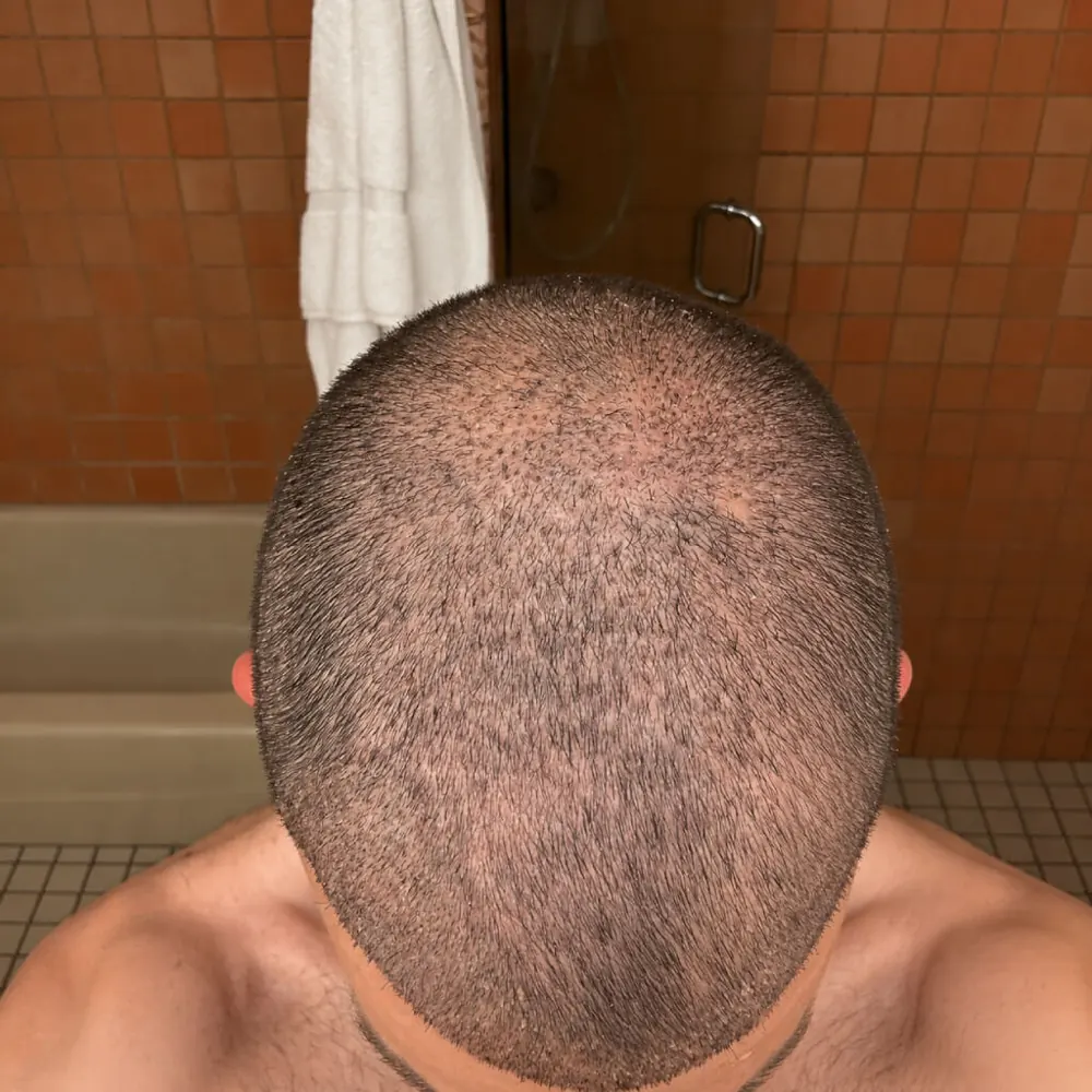 Day 10