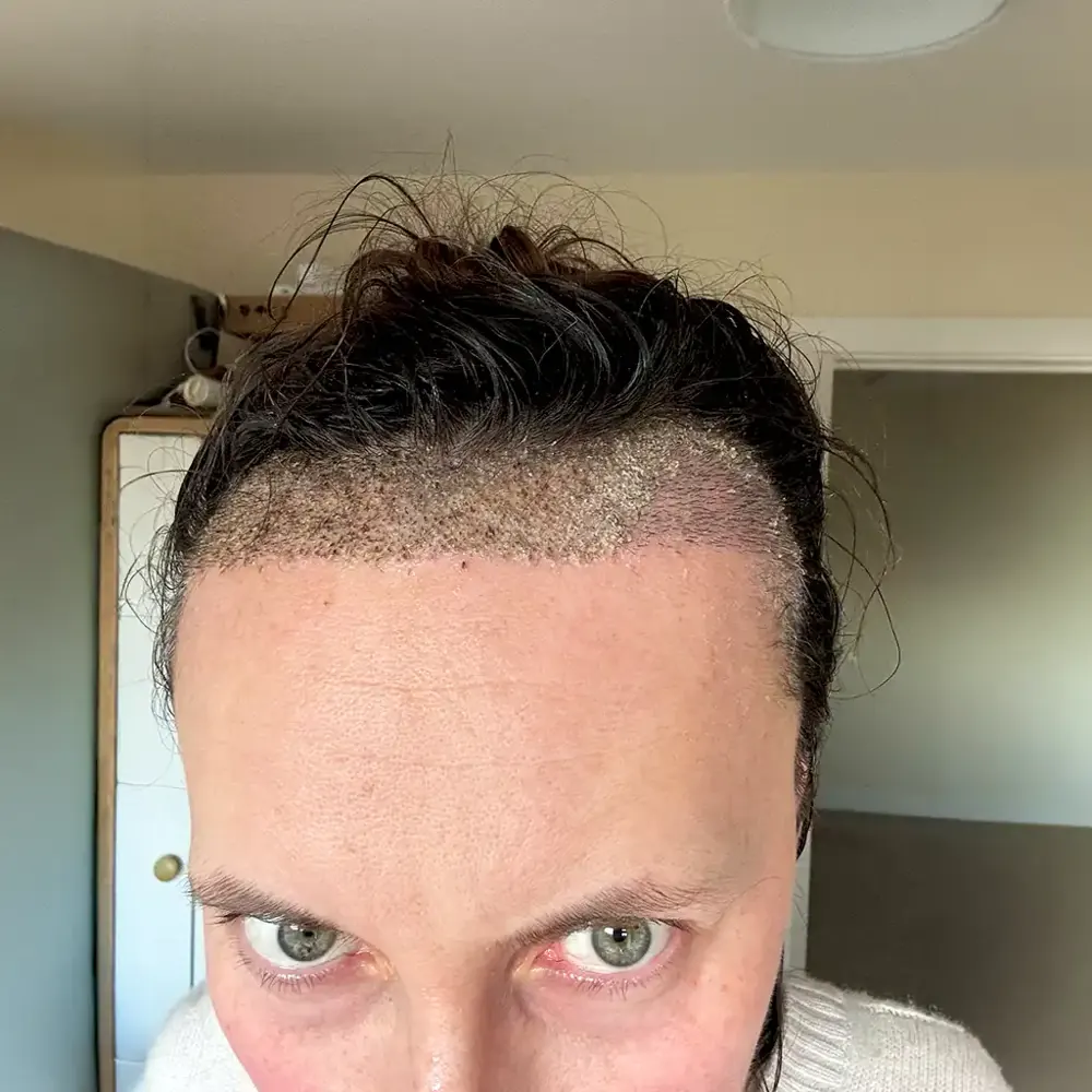 Day 10