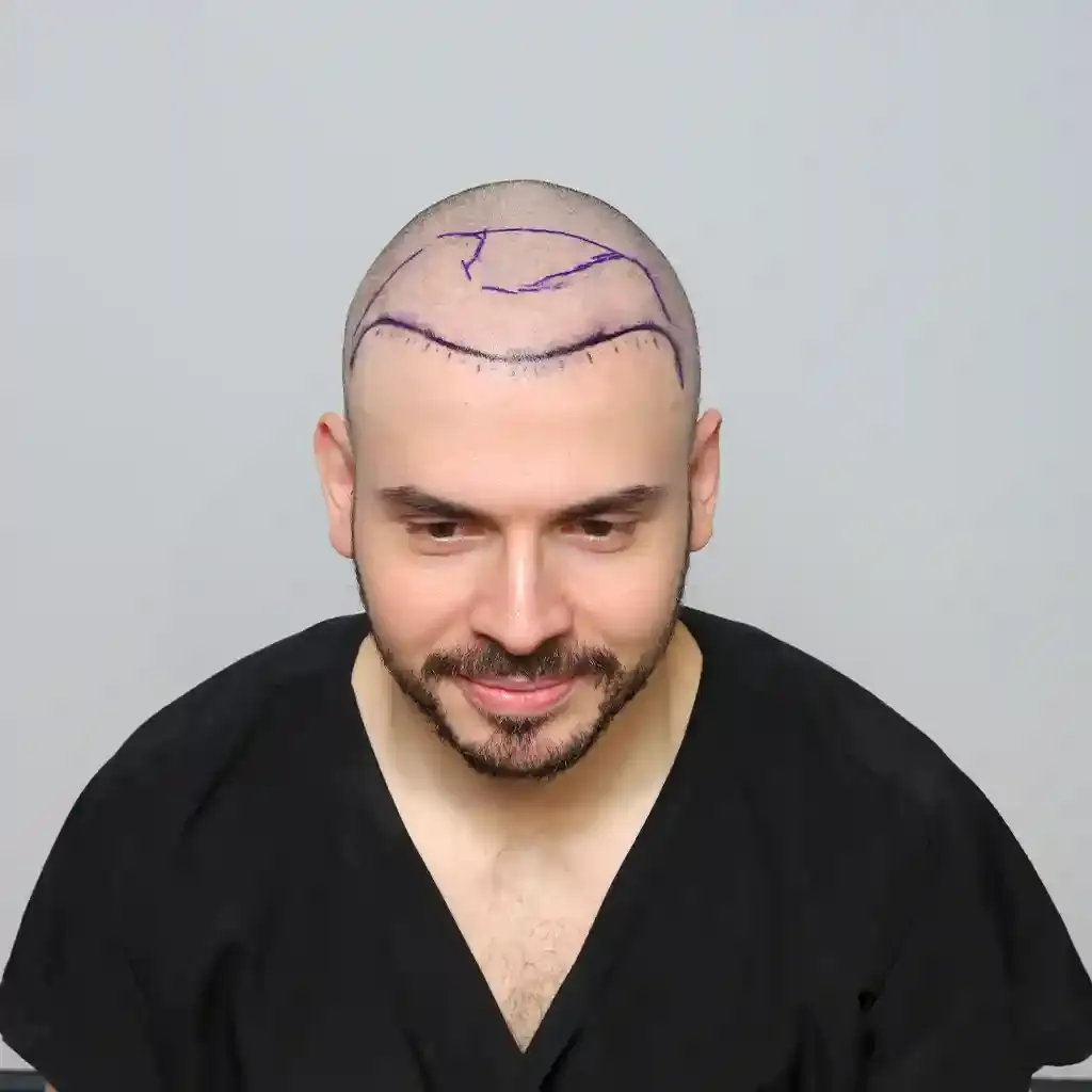 قبل