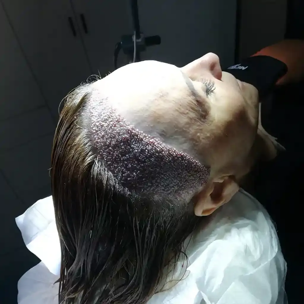 Operation day
