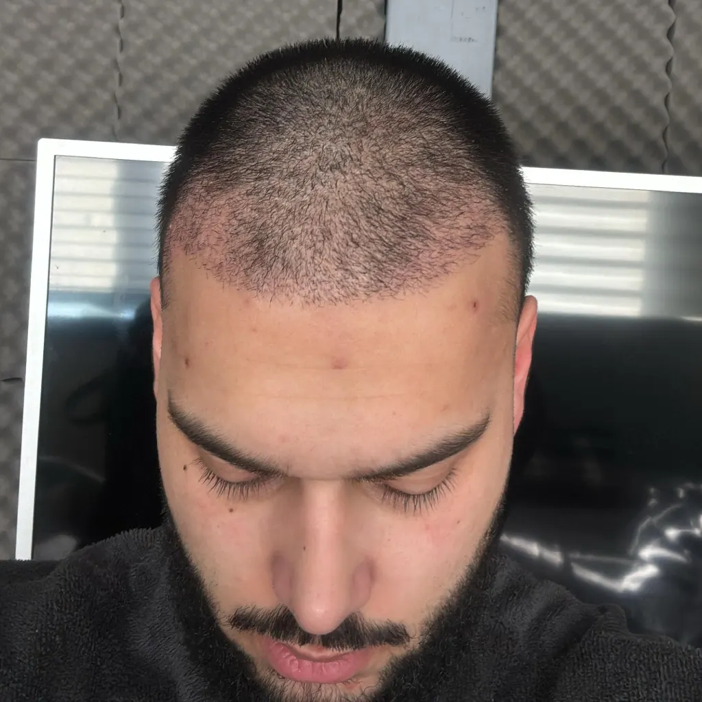 Day 26