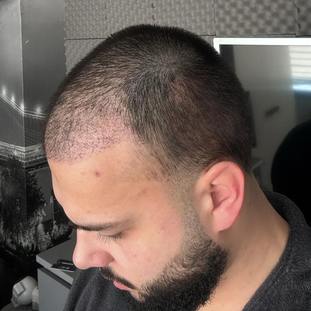 Day 26