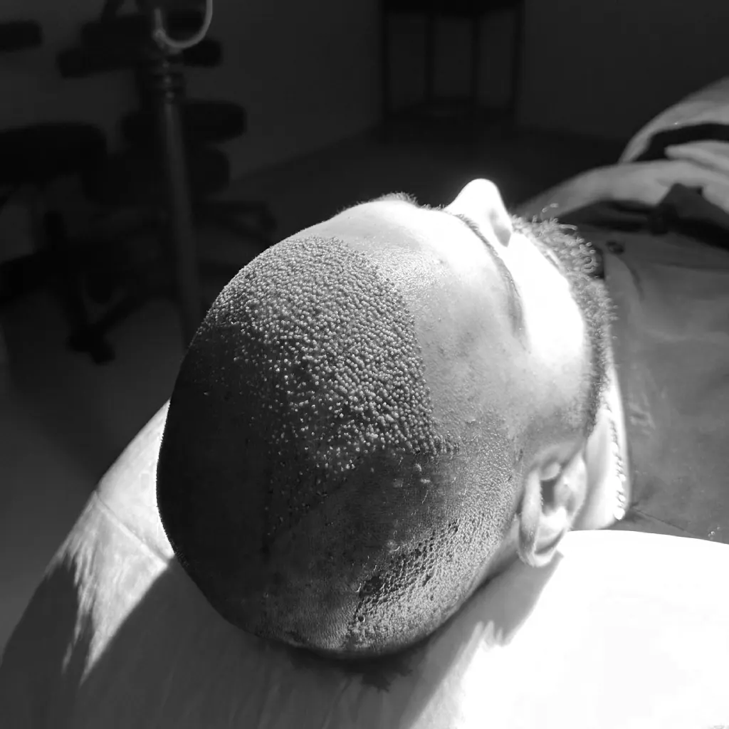 Operation day