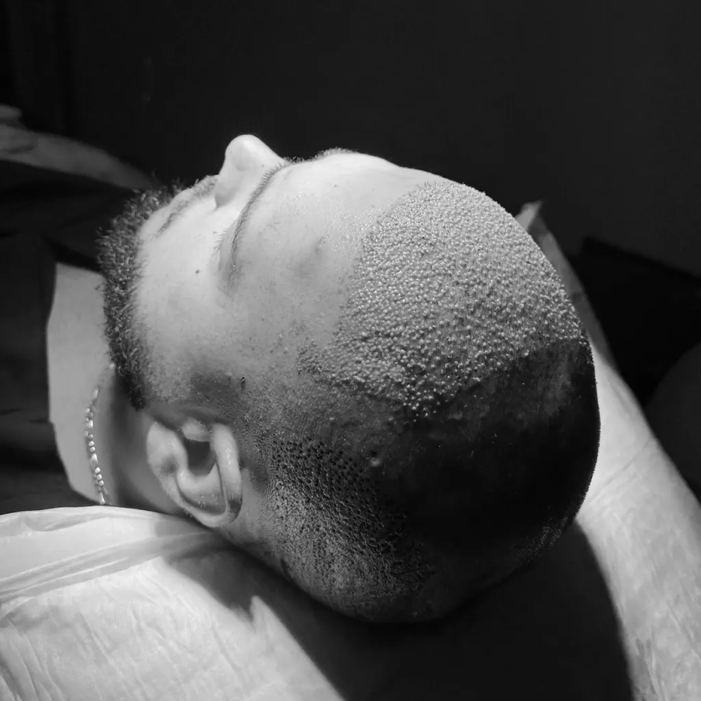 Operation day