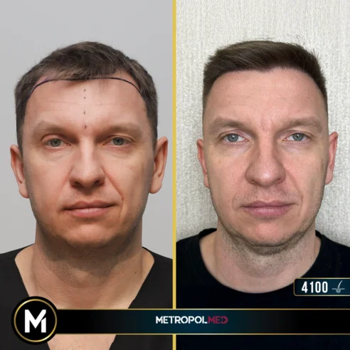 50