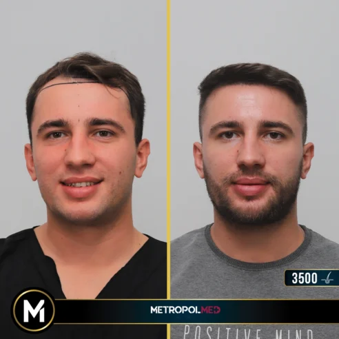 53