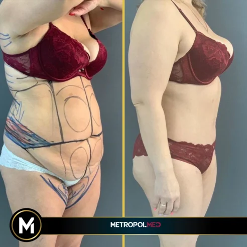 momy-makeover2